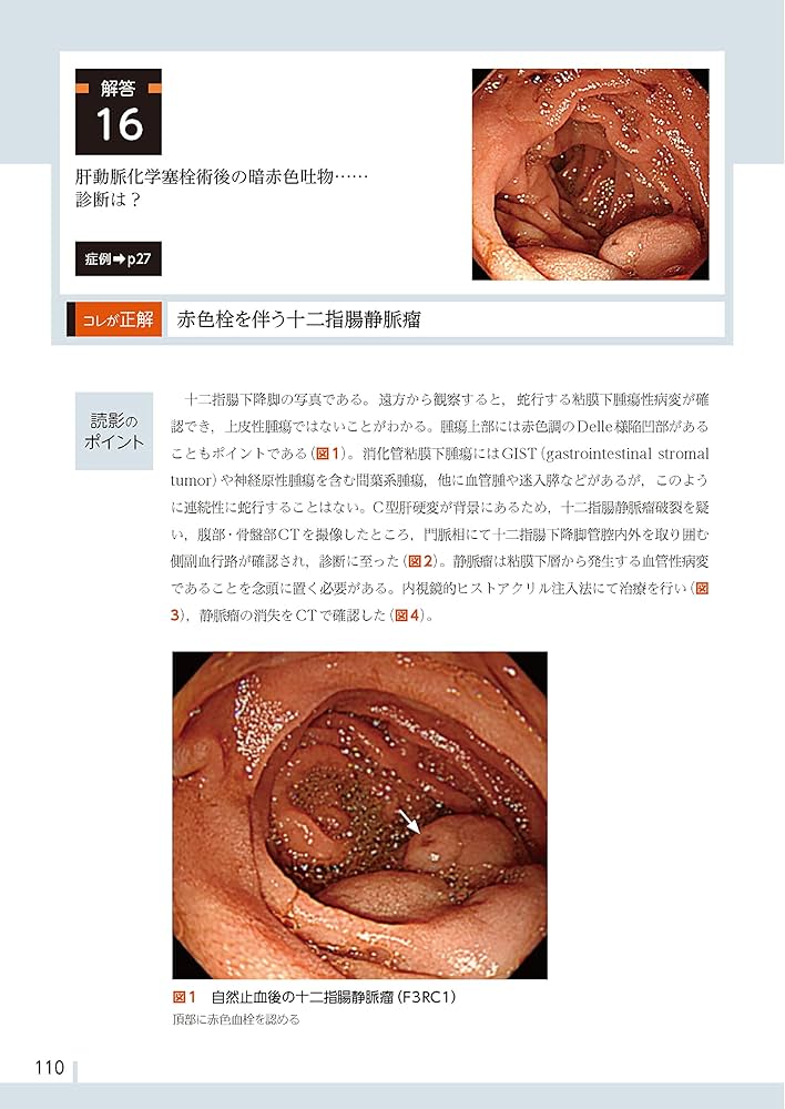 腹部画像診断アトラスⅫ 臨床画像 2025年4月増刊号 特集：腹部画像診断における画像と